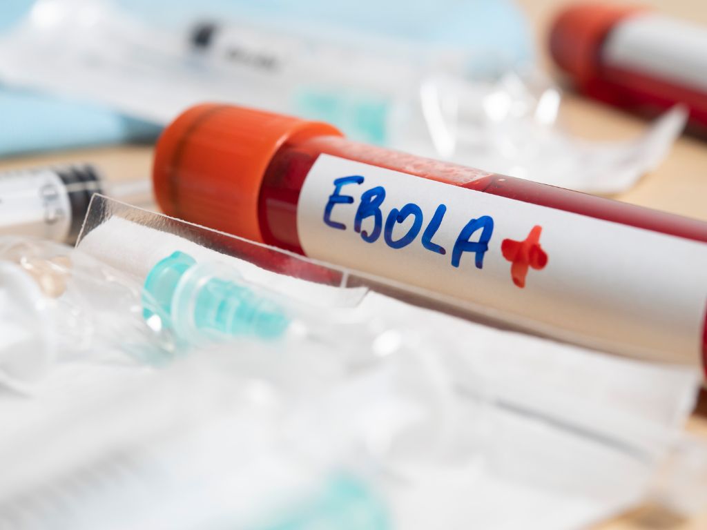 ébola